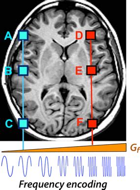 Afbeeldingsresultaten voor Phase Encoding Gradient MRI