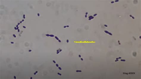 Image result for Strep Gram-positive