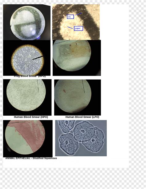 Toradh íomhá ar Blood Circle PNG