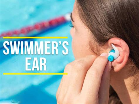 Afbeeldingsresultaten voor What Is Swimmer's Ear