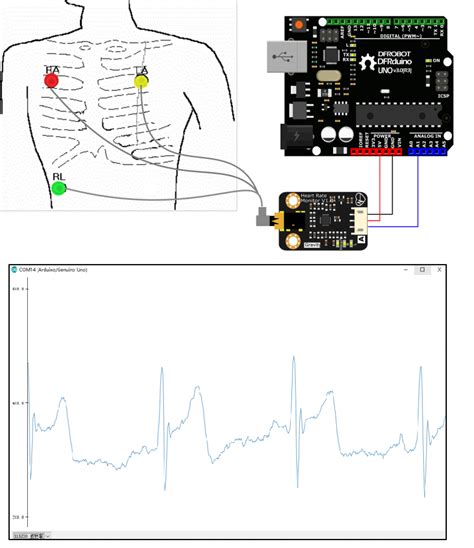 Heart Rate Monitor Using Arduino に対する画像結果