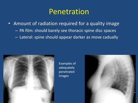 Image result for Infiltrate Base Film