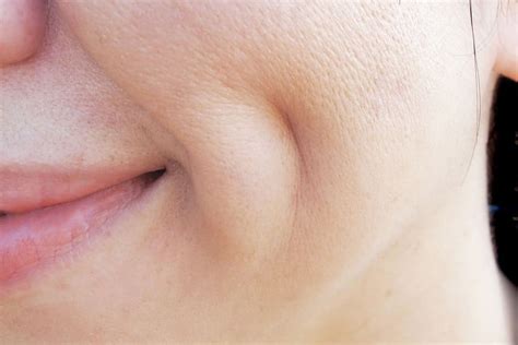 Image result for Cheek Dimples