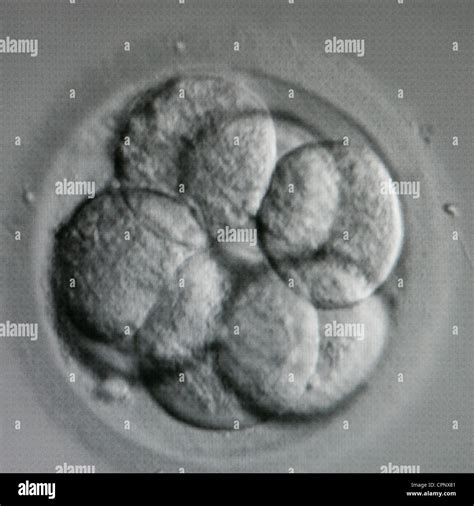 Image result for Human Embryo Electron Microscope