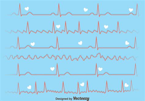 Image result for Heart Rythum Simulatar