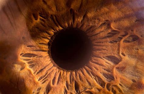 Image result for Eye Pops Out of Socket