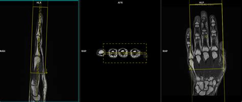 Image result for Scan Middle Finger