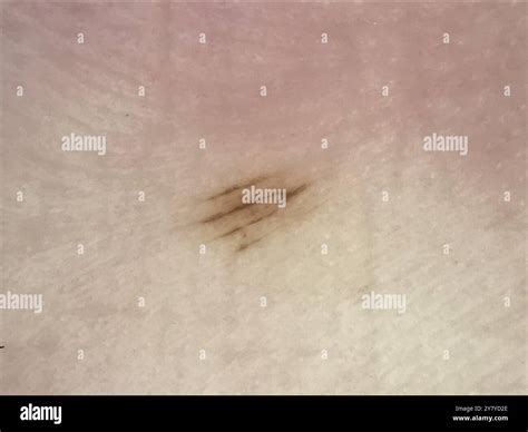 Toradh íomhá ar Parallel Furrow Pattern