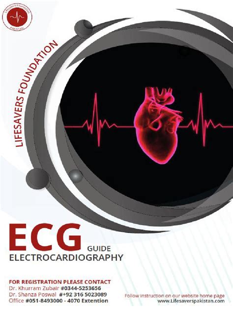 Image result for ECG Step by Step Guide