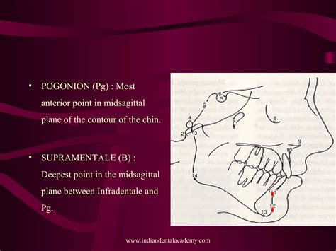 Image result for Perpendicular Cogs