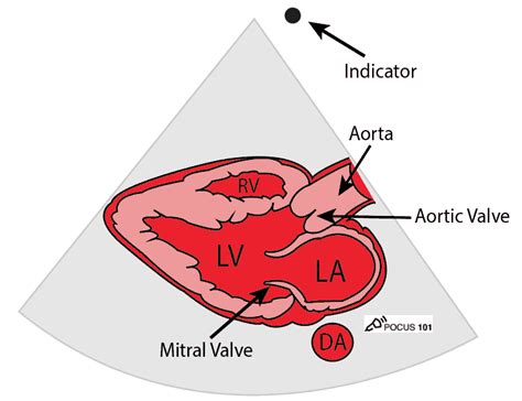 Image result for Parasternal Long Axis Ultrasound
