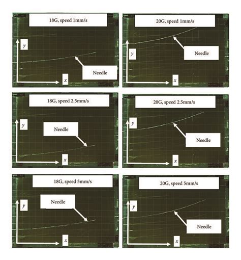 Image result for Full Needle Deflection