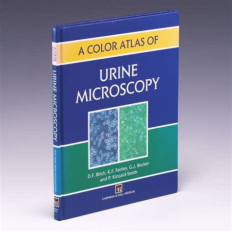 Image result for Urine Cell Atlas