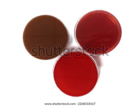 Blood and MacConkey Agar に対する画像結果