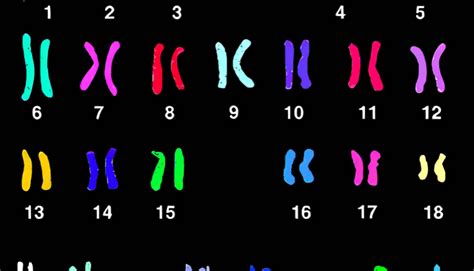 Afbeeldingsresultaten voor Karyotype vs Microarray