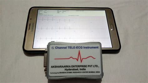 ECG Device に対する画像結果
