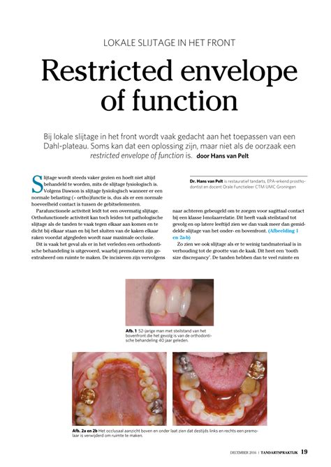 Restricted Envelope of Function に対する画像結果