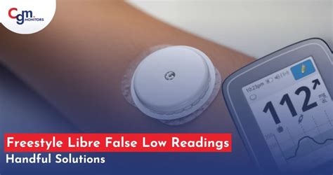 Toradh íomhá ar Compatible Android Phones for Dexcom G7 and Op5