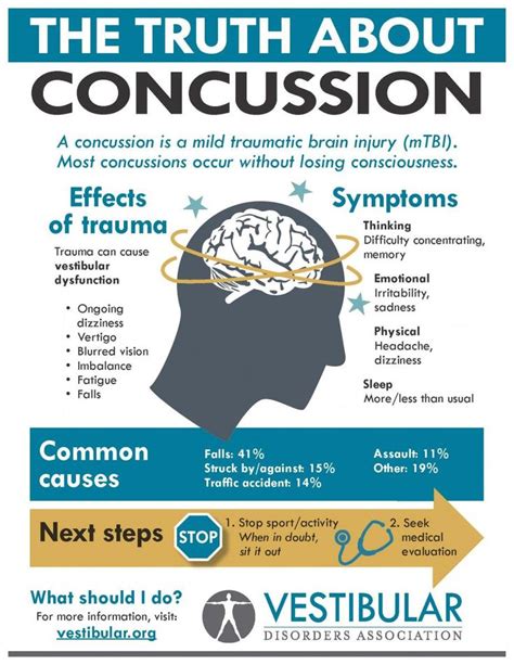 Toradh íomhá ar Concussion Brain Diagram