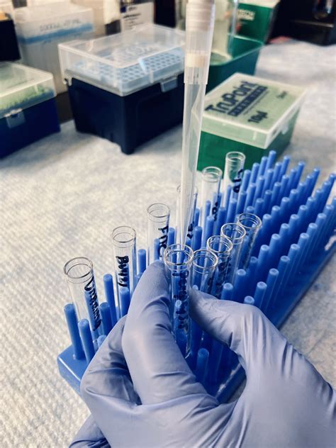 Image result for SPT Lab Tech Logo