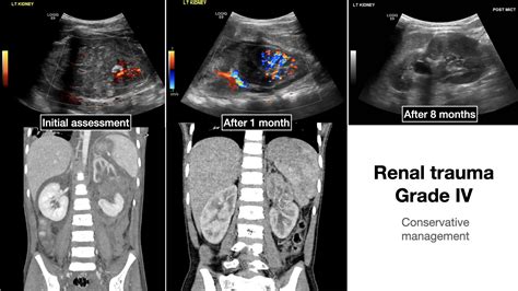 Afbeeldingsresultaten voor Pediatric Renal Trauma Algorithm