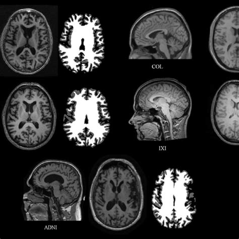 MRI Registration Python に対する画像結果