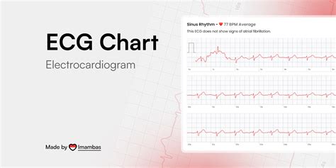 Electric Cardiogram Chart に対する画像結果