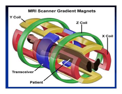 Image result for MRI Gradient Distribution Plot