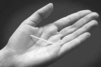 Nexplanon Implant Logo に対する画像結果