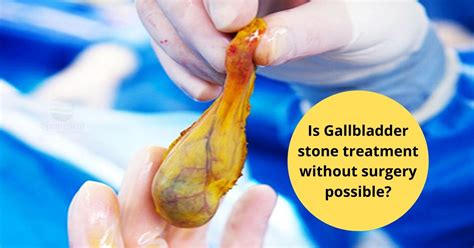 Image result for Gallbladder Removal