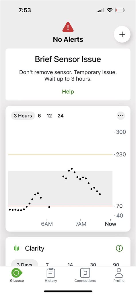 Restart Dexcom Sensor に対する画像結果