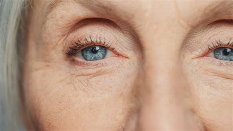 Toradh íomhá ar Multifocal IOL