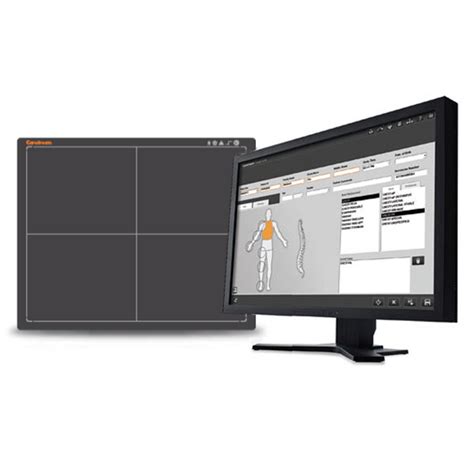 Carestream Detector માટે ઇમેજ પરિણામ