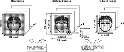Image result for Lace Image Preprocessing