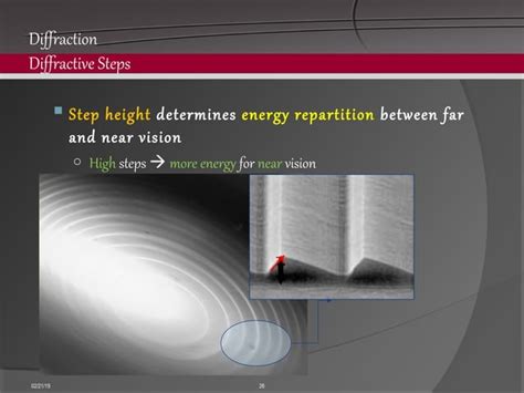 Image result for Kenneth Hoffer Multifocal IOL