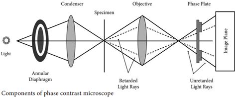 Image result for Unitron Microscope Phase Contrast