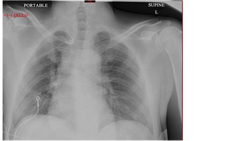 Image result for Open PFO File