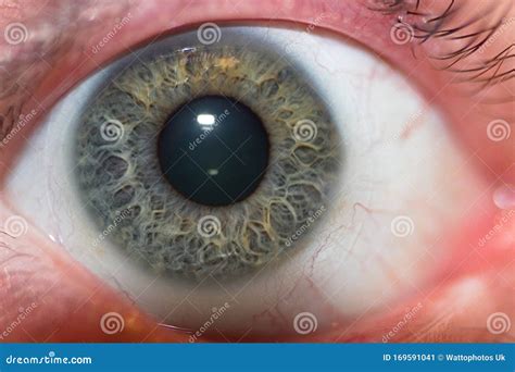 Image result for Real Human EyeBall
