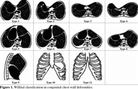 Image result for Abnormal Wall Defects Classification