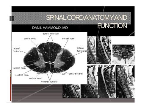 Spinal Cord Structure and Function に対する画像結果