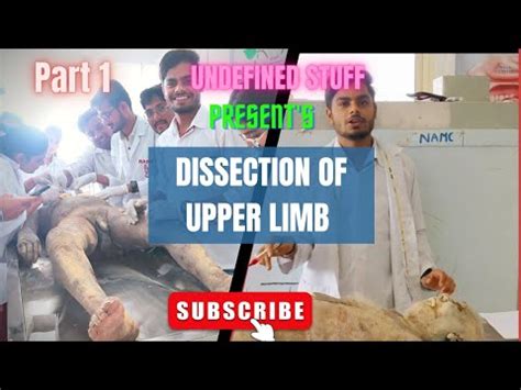 Upper Limb Dissection に対する画像結果