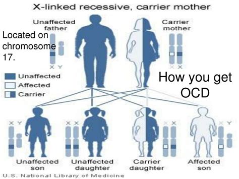 Image result for Obsessive Cleanliness Disorder