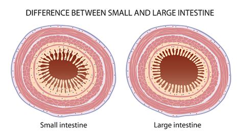 Difference Between Small and Large Code Set ಗಾಗಿ ಇಮೇಜ್ ಫಲಿತಾಂಶ
