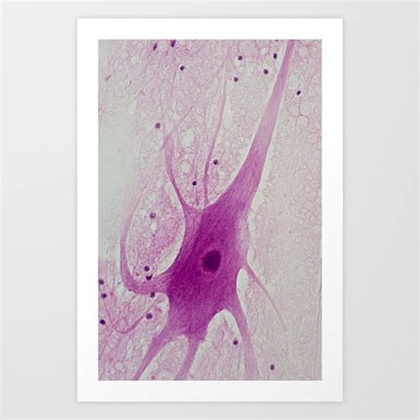 Image result for MS Neuron Microscope