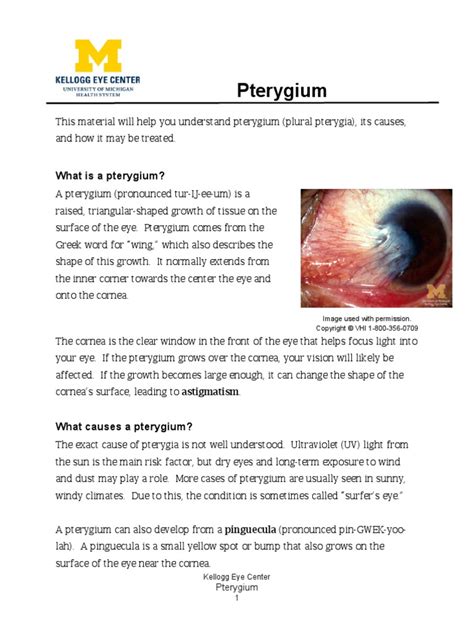 Image result for Pterygium Consent Form