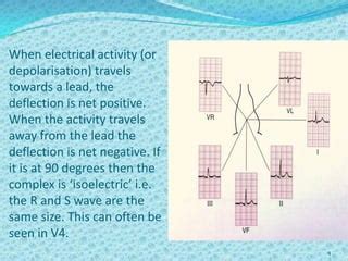 Image result for Positive and Negative Deflection ECG