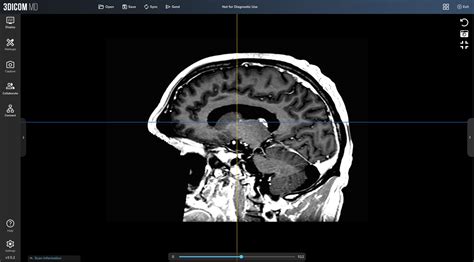 Toradh íomhá ar Neuroradiology Brain Scan