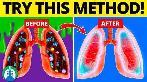 Toradh íomhá ar Mucus Body