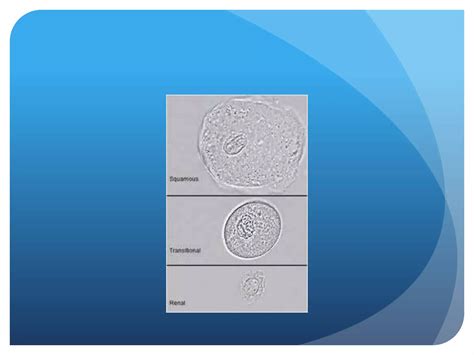 Microscopy Urine Examination に対する画像結果