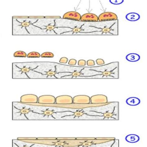 Image result for Process Bone